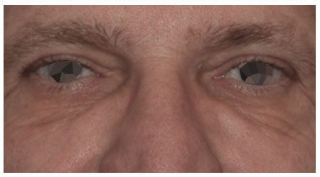 eyebrow-a-1 eyebrow-a-1
