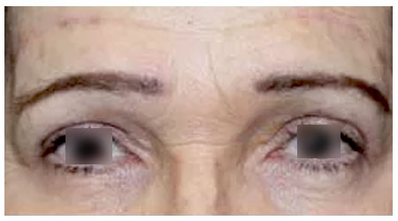 eyebrow-a-3 eyebrow-a-3