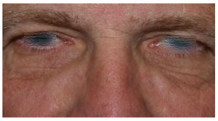 eyebrow-b-1 eyebrow-b-1