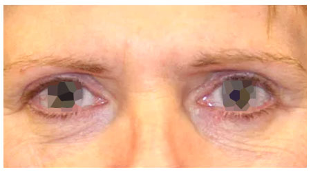 eyebrow-b-2 eyebrow-b-2