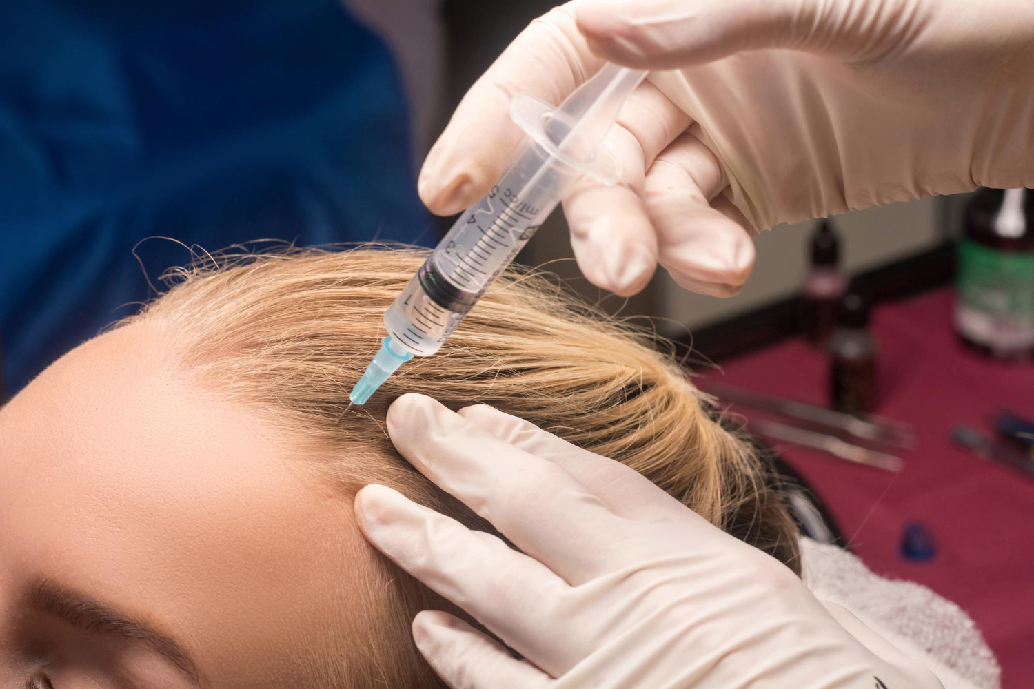 advanced hair treatment cllinic-n